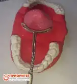 Логопедическое устройство для поднятия языка1